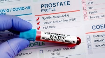 My PSA is High: Does That Mean I Have Prostate Cancer?