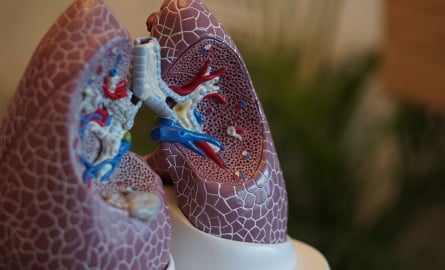 VOA Selected as one of 10 Sites for New Clinical Trial MYLUNG
