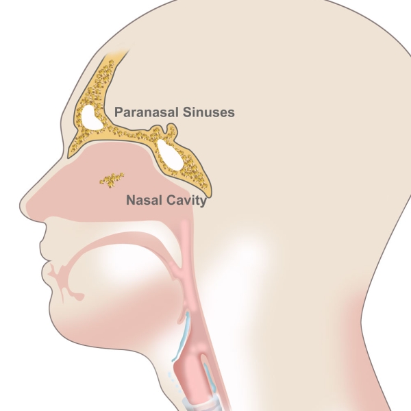 Paranasal Sinuses and Nasal Cavity